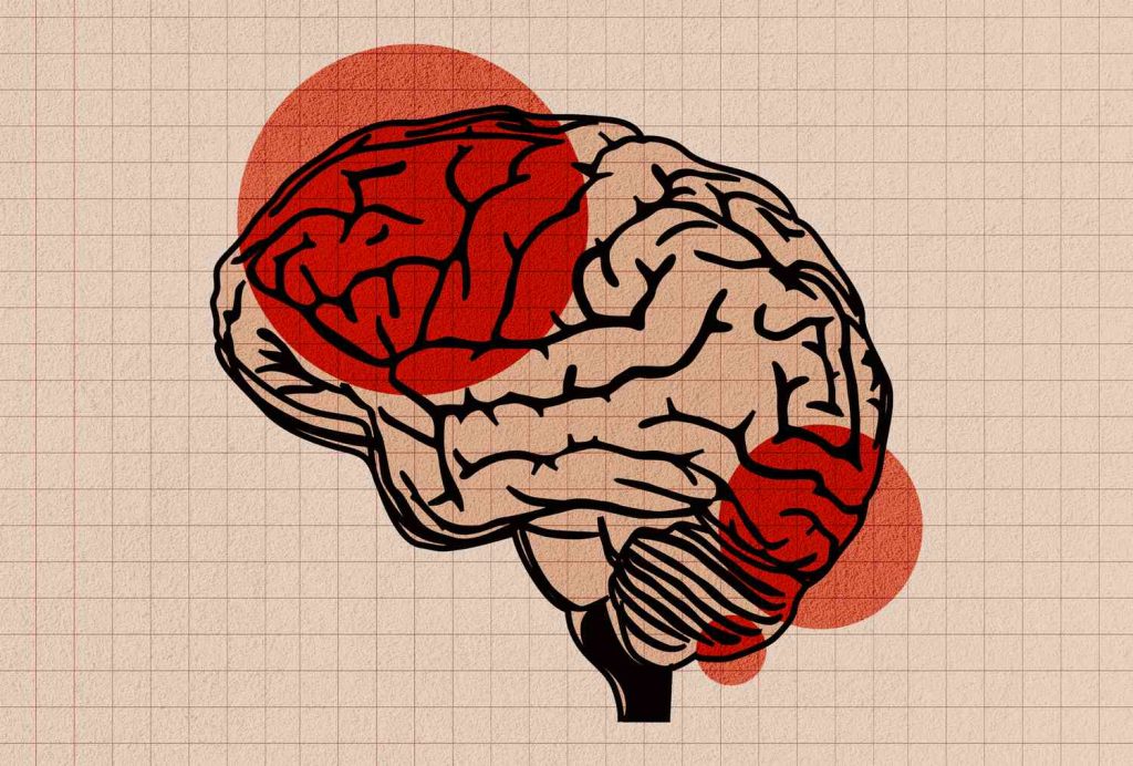 The Age You're Diagnosed with Diabetes Could Predict Your Dementia Risk, According to a New Study