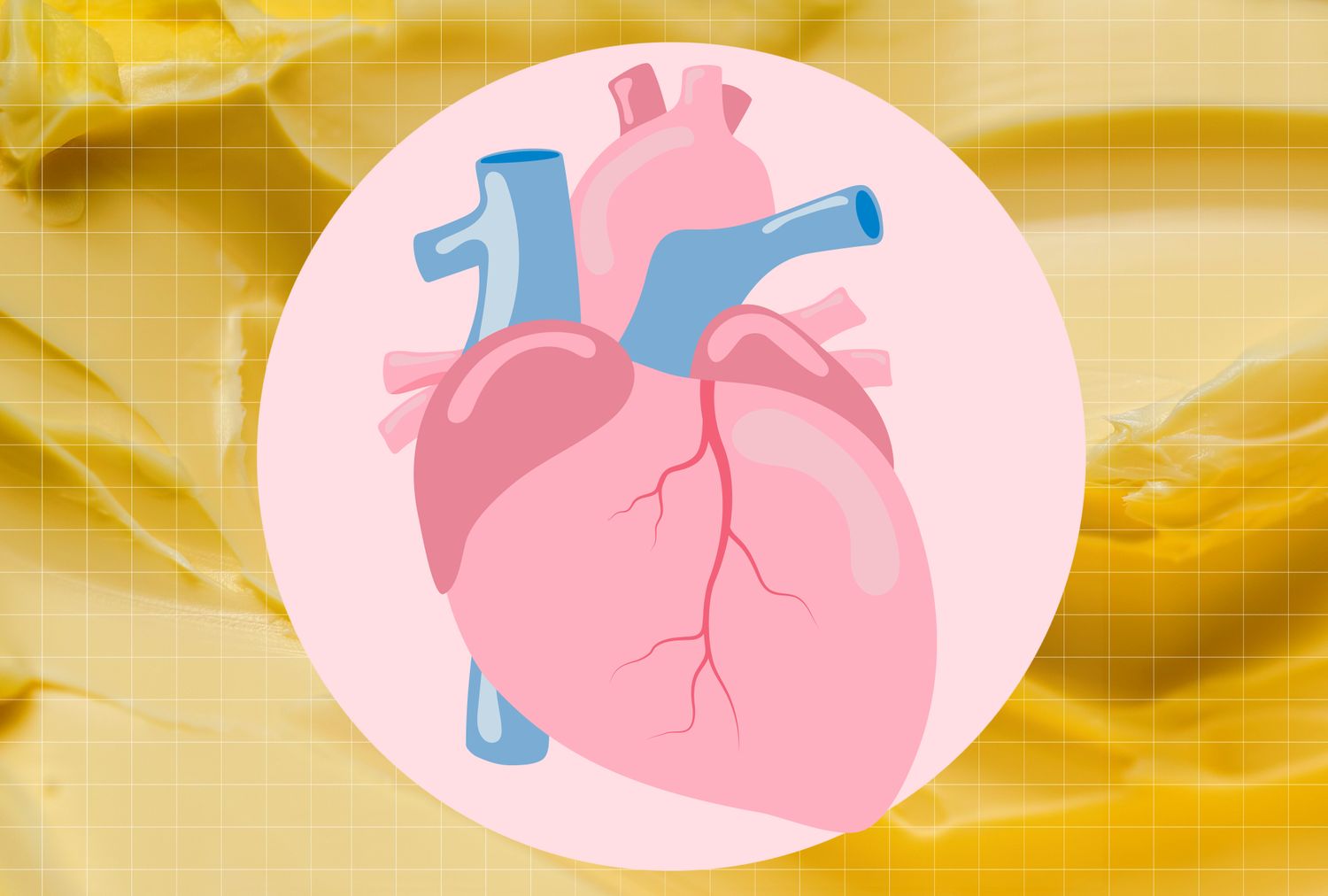 สุขภาพหัวใจ, เนย, ผลกระทบ